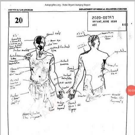 kobe and gigi autopsy|File : Kobe Bryants autopsy report, 2020.pdf